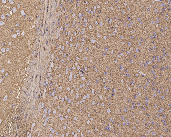 GLT-1 Antibody in Immunohistochemistry (Paraffin) (IHC (P))