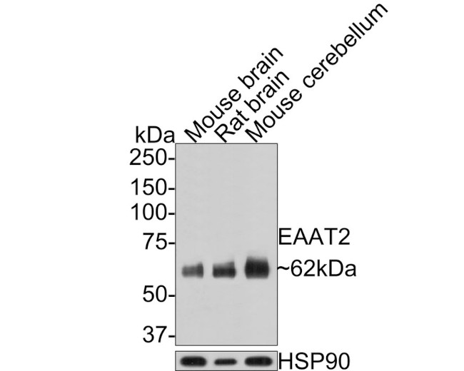 GLT-1 Antibody in Western Blot (WB)