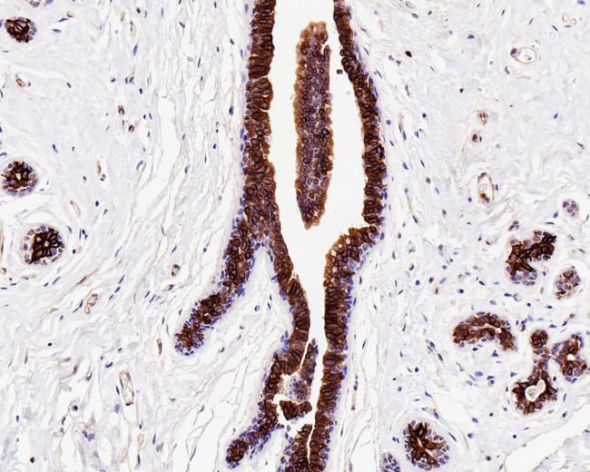 BAX Antibody in Immunohistochemistry (Paraffin) (IHC (P))