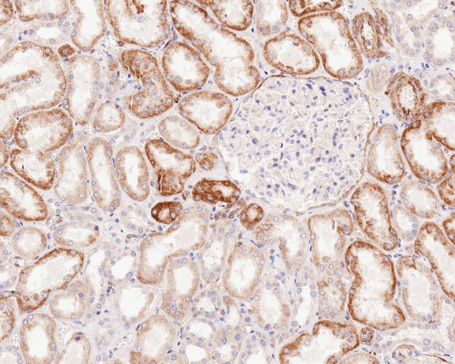 BAX Antibody in Immunohistochemistry (Paraffin) (IHC (P))