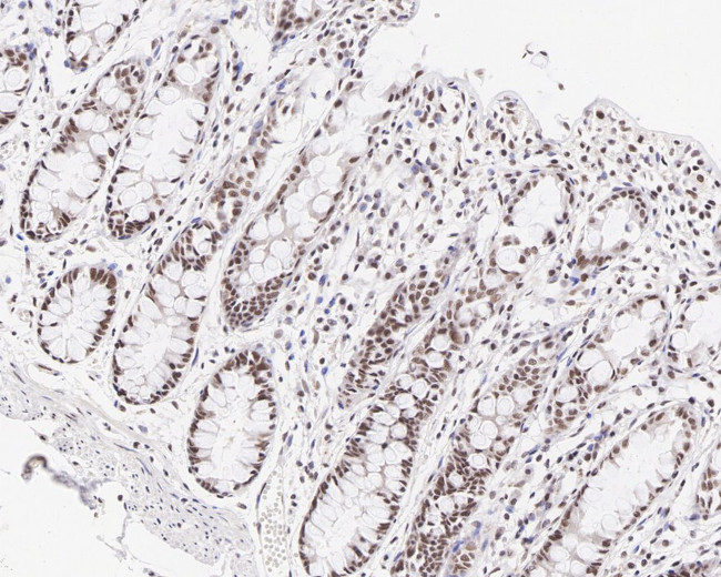 MLH1 Antibody in Immunohistochemistry (Paraffin) (IHC (P))