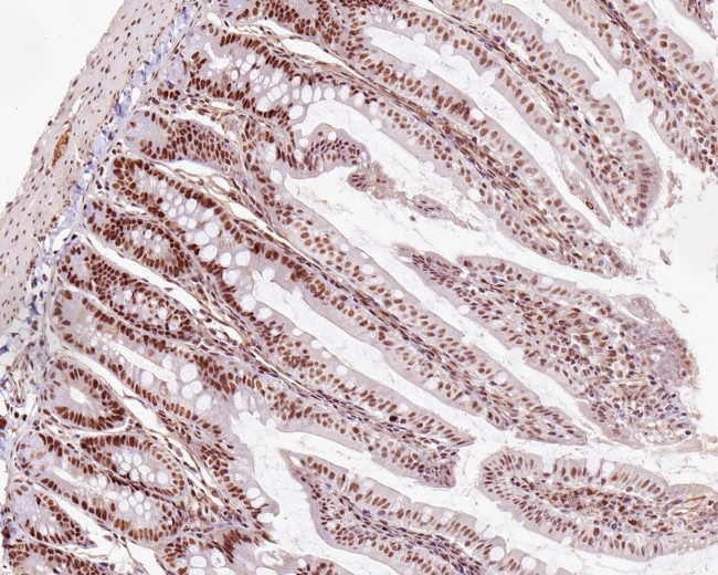 MLH1 Antibody in Immunohistochemistry (Paraffin) (IHC (P))