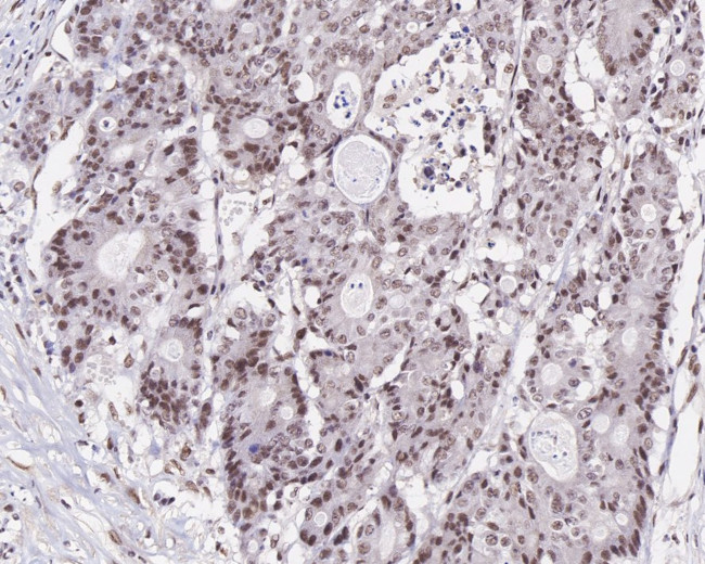 MLH1 Antibody in Immunohistochemistry (Paraffin) (IHC (P))