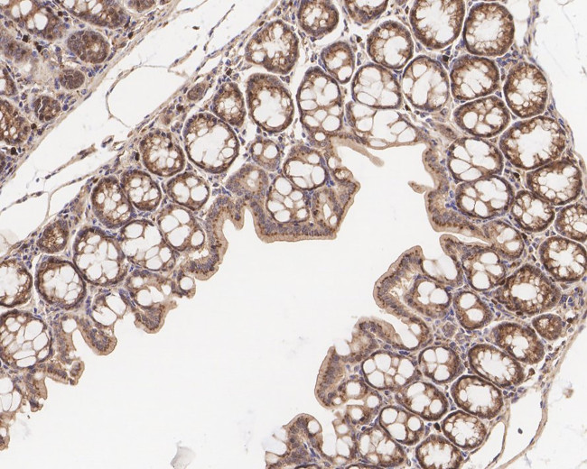 GNAQ Antibody in Immunohistochemistry (Paraffin) (IHC (P))