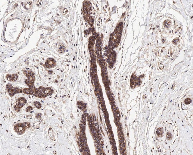 GNAQ Antibody in Immunohistochemistry (Paraffin) (IHC (P))