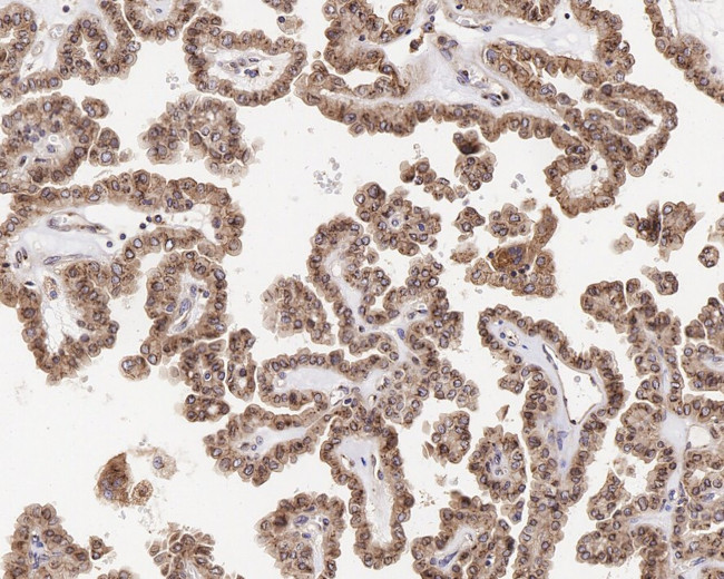 GNAQ Antibody in Immunohistochemistry (Paraffin) (IHC (P))