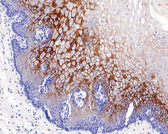 LYPD3 Antibody in Immunohistochemistry (Paraffin) (IHC (P))