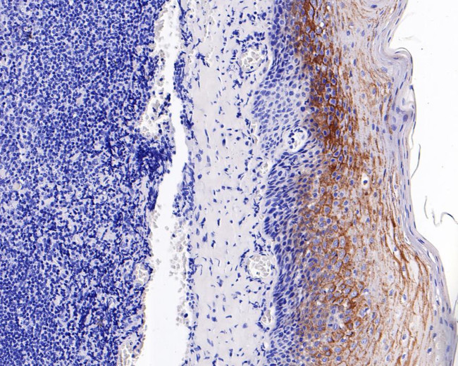 LYPD3 Antibody in Immunohistochemistry (Paraffin) (IHC (P))