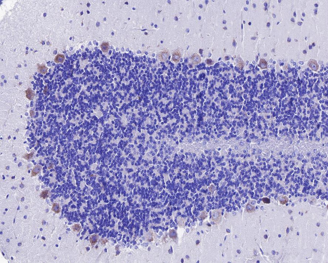 SORL1 Antibody in Immunohistochemistry (Paraffin) (IHC (P))