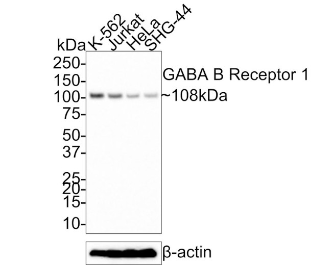 GABBR1 Antibody in Western Blot (WB)