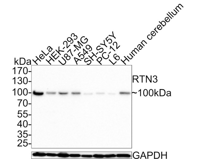 RTN3 Antibody in Western Blot (WB)