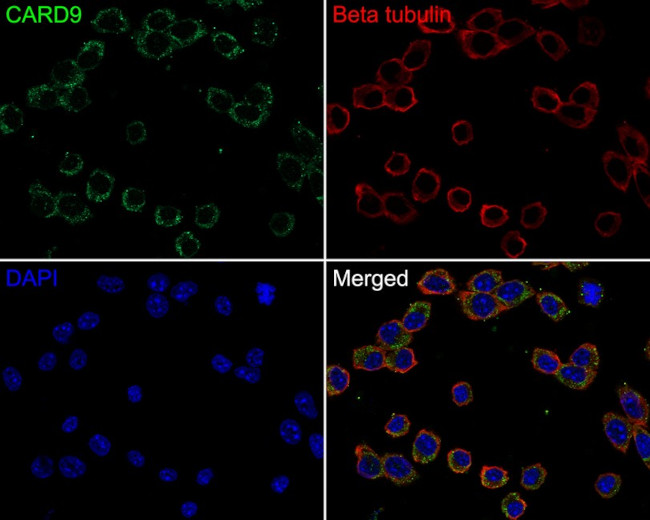 CARD9 Antibody in Immunocytochemistry (ICC/IF)