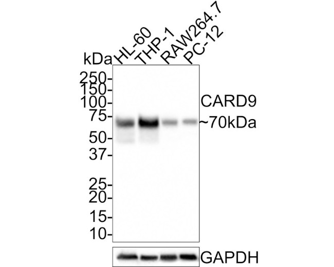 CARD9 Antibody in Western Blot (WB)