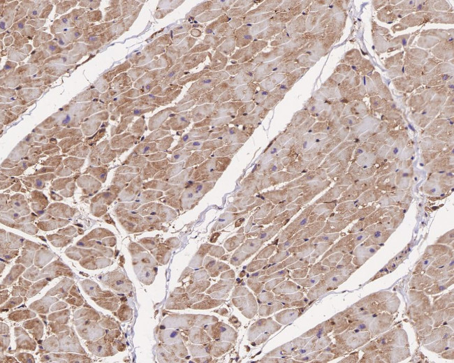 Arp2 Antibody in Immunohistochemistry (Paraffin) (IHC (P))