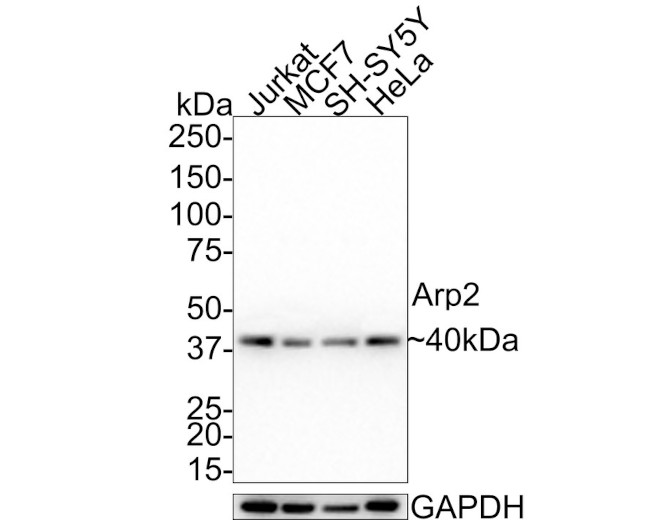 Arp2 Antibody in Western Blot (WB)