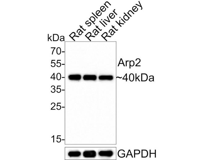 Arp2 Antibody in Western Blot (WB)