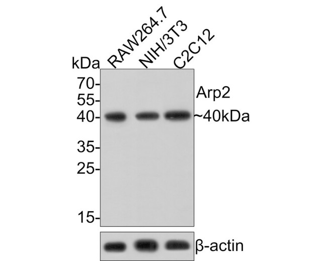 Arp2 Antibody in Western Blot (WB)