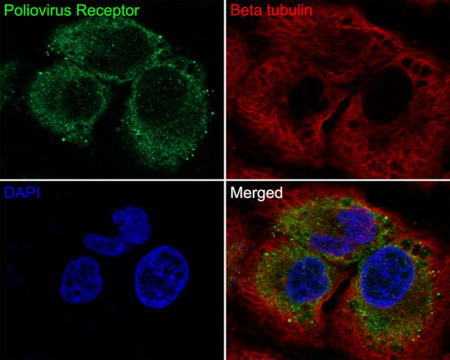 CD155 Antibody in Immunocytochemistry (ICC/IF)