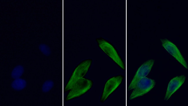 beta Tubulin Antibody in Immunocytochemistry (ICC/IF)