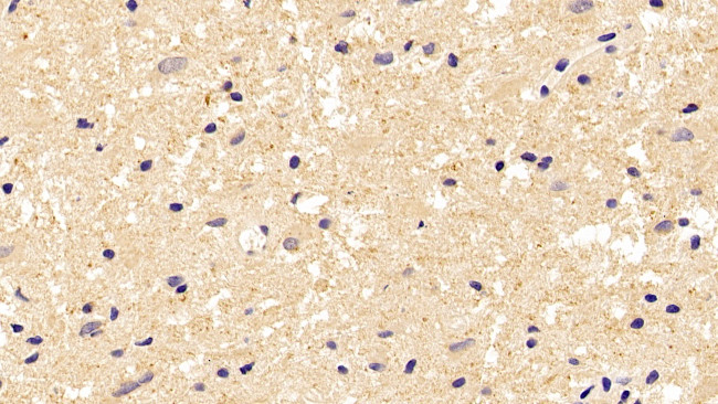 beta Tubulin Antibody in Immunohistochemistry (Paraffin) (IHC (P))