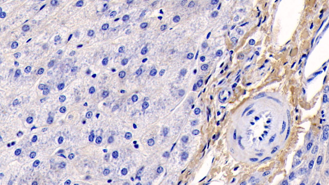 COL1A1 Antibody in Immunohistochemistry (Paraffin) (IHC (P))