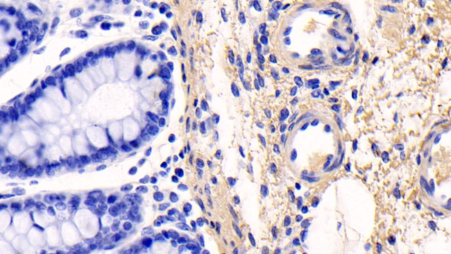 COL1A1 Antibody in Immunohistochemistry (Paraffin) (IHC (P))