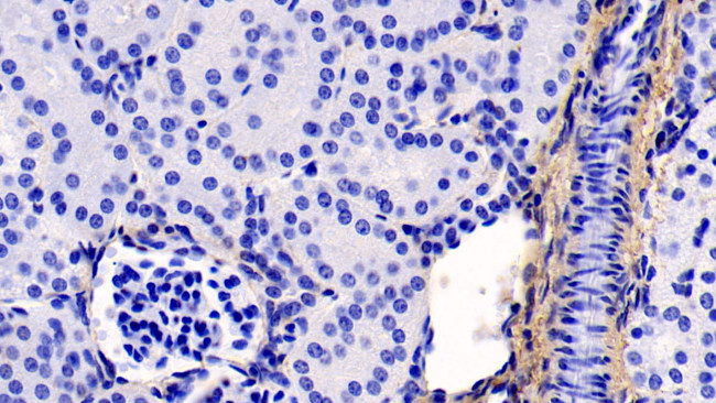 COL1A1 Antibody in Immunohistochemistry (Paraffin) (IHC (P))