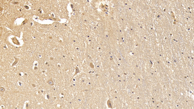 Dystrophin Antibody in Immunohistochemistry (Paraffin) (IHC (P))