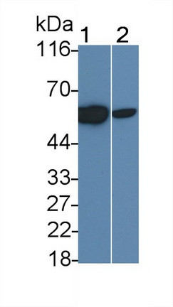 CD122 Antibody in Western Blot (WB)