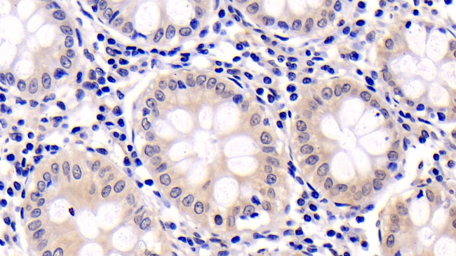 ERK2 Antibody in Immunohistochemistry (Paraffin) (IHC (P))