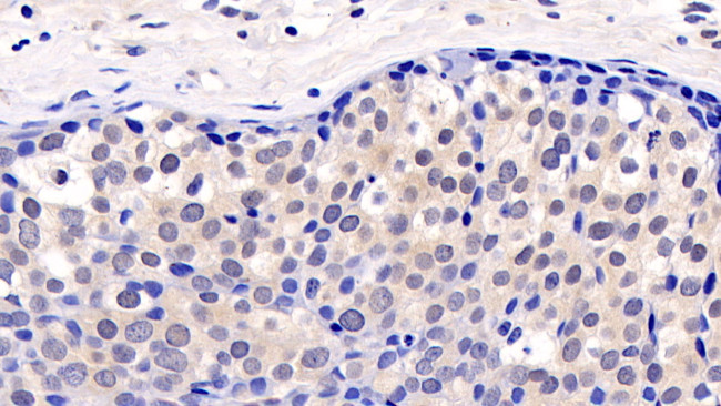 ERK2 Antibody in Immunohistochemistry (Paraffin) (IHC (P))