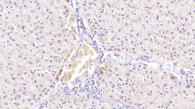 SIRT3 Antibody in Immunohistochemistry (Paraffin) (IHC (P))