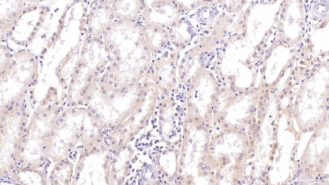 SIRT3 Antibody in Immunohistochemistry (Paraffin) (IHC (P))