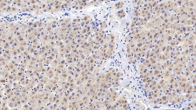 CEACAM1 Antibody in Immunohistochemistry (Paraffin) (IHC (P))