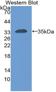 CEACAM1 Antibody in Western Blot (WB)