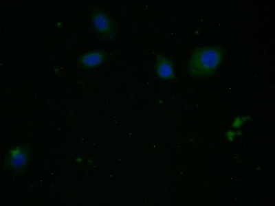 Arginase 1 Antibody in Immunocytochemistry (ICC/IF)