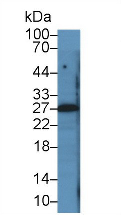 PTHLH Antibody in Western Blot (WB)