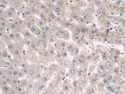 A1BG Antibody in Immunohistochemistry (Paraffin) (IHC (P))