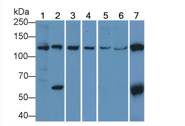 Vinculin Antibody in Western Blot (WB)