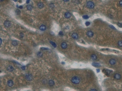 Haptoglobin Antibody in Immunohistochemistry (Paraffin) (IHC (P))