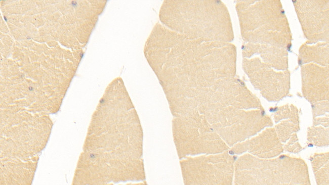 GPT Antibody in Immunohistochemistry (Paraffin) (IHC (P))