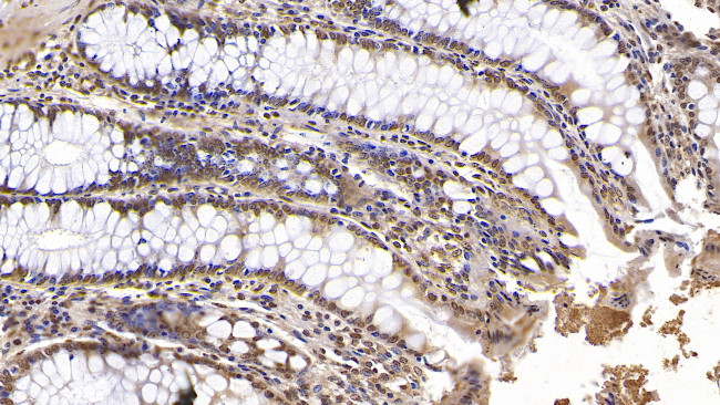 KPNA2 Antibody in Immunohistochemistry (Paraffin) (IHC (P))