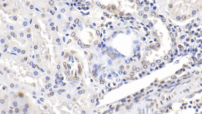 ENO1 Antibody in Immunohistochemistry (Paraffin) (IHC (P))