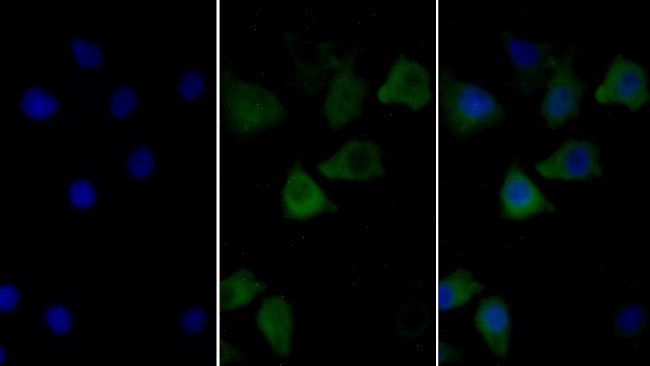 Calnexin Antibody in Immunocytochemistry (ICC/IF)