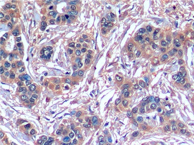 SERPINB3 Antibody in Immunohistochemistry (Paraffin) (IHC (P))