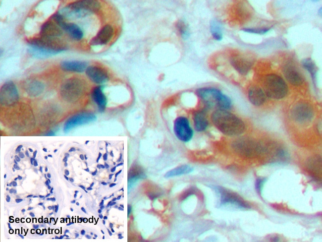 HSPA1A Antibody in Immunohistochemistry (Paraffin) (IHC (P))