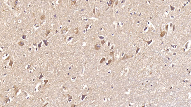 DCLK1 Antibody in Immunohistochemistry (Paraffin) (IHC (P))