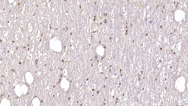 DCLK1 Antibody in Immunohistochemistry (Paraffin) (IHC (P))