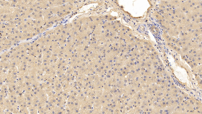 Prothrombin Fragment 1/2 Antibody in Immunohistochemistry (Paraffin) (IHC (P))