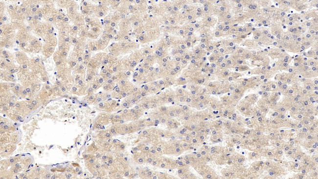 Prothrombin Fragment 1/2 Antibody in Immunohistochemistry (Paraffin) (IHC (P))